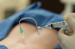 Picture of a spinal injection for pain relief