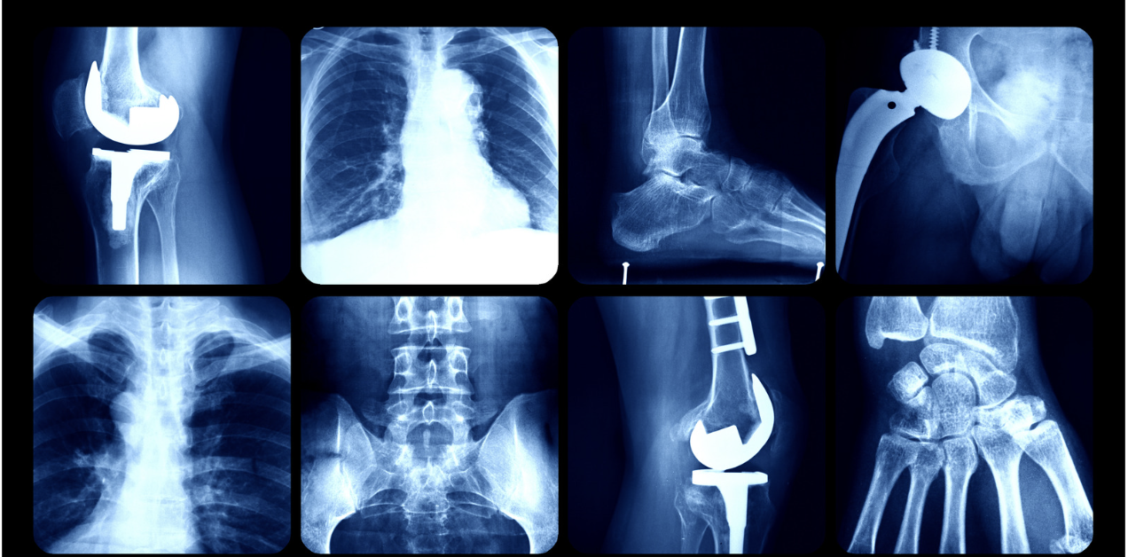X-Ray (walk-in) - Partners Imaging Centers | 3T MRI, CT, X-Ray, PET ...
